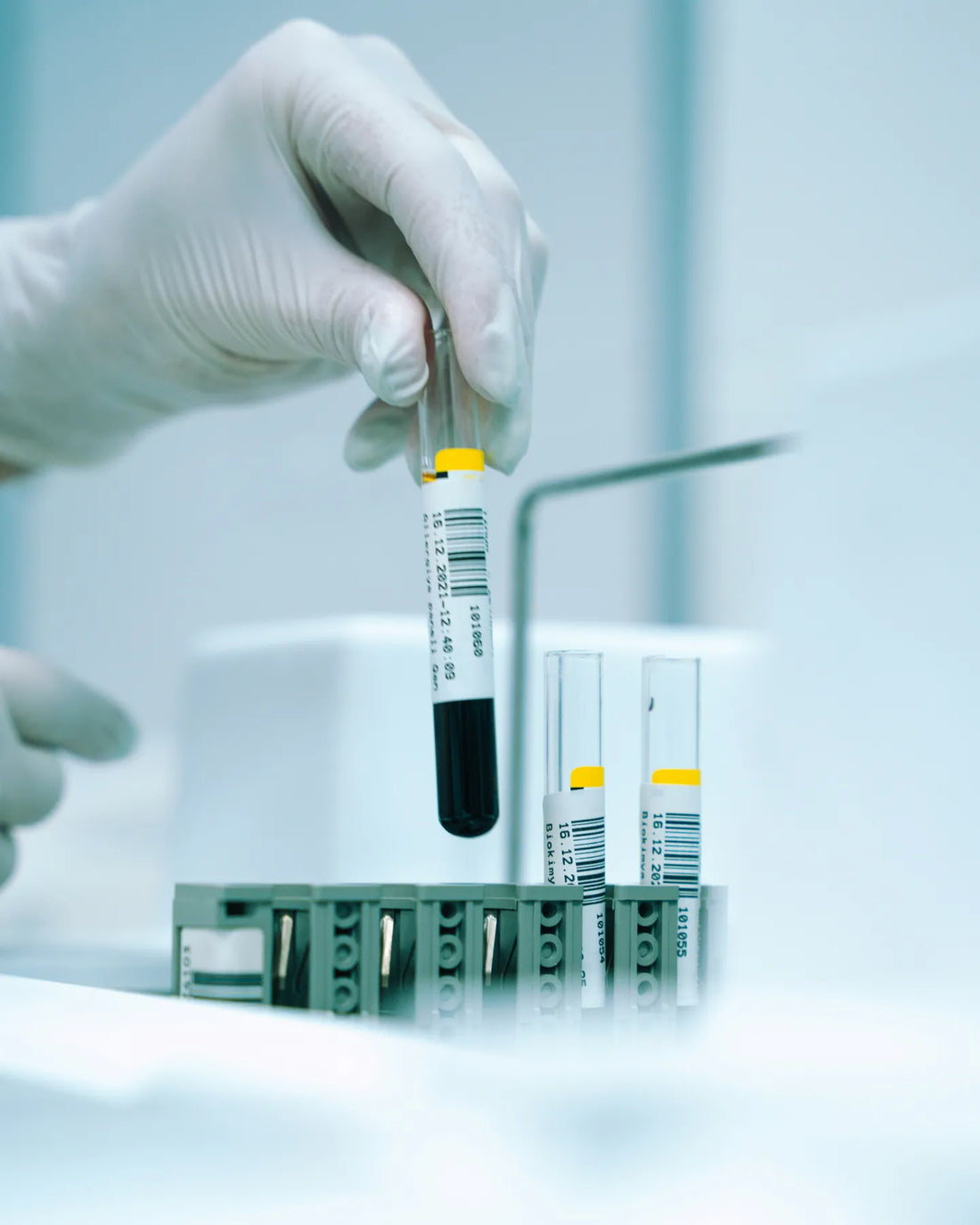 Autoanalisi del sangue